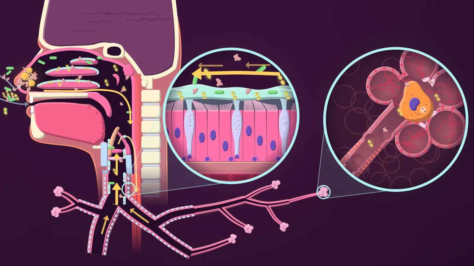 Illustration of the airway's defences: the nose filtering particles, the mucociliary escalator, and an alveolar macrophage